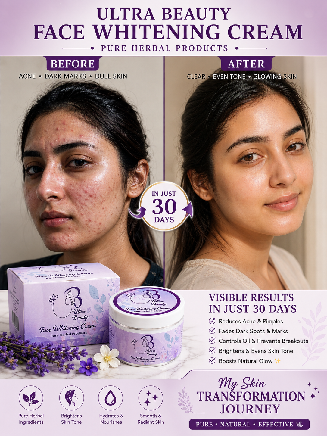 UB Pure Herbal Face Whitening Cream